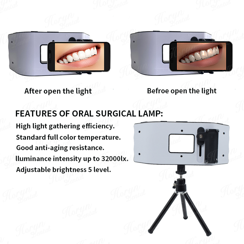 Luce flash dentale Attrezzatur - Photography Lighting Equipment recensione e prezzo